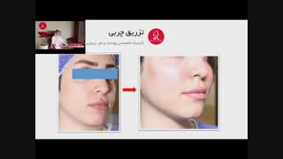 تزریق چربی | فیلم تزریق چربی | کلینیک پوست و مو رز دندان پیش