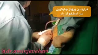 عمل جراحی پروتز جایگزینی سر استخوان ران توسط دکتر جواهری