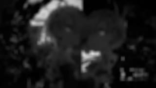 Attack on Titan season 3 armored titan vs beast titan