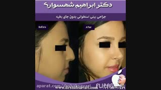 جراحی زیبایی بینی