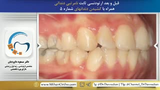 ارتودنسی ثابت | متخصص ارتودنسی در تهران