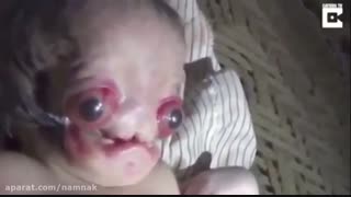 تولد ترسناک ترین نوزاد جهان