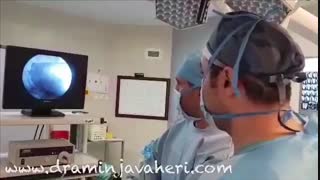 بازسازی رباط صلیبی قدامی به کمک اتوگرفت (پارت1)