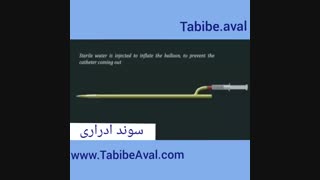 سوند ادراری