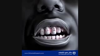 رابطه جذاب دندان ها
