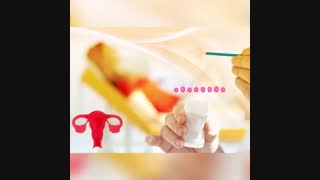 صحبت های دکتر زارع پور در مورد سرطان دهانه رحم