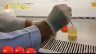 آزمایش کشت ادرار