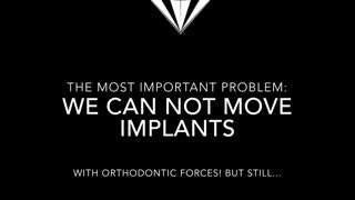 ارتودنسی بعد از ایمپلنت ممکن است؟