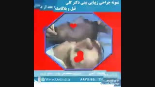 نمونه جراحی بینی