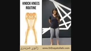 ورزش هایی برای زانوی ضربدری