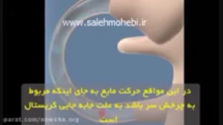 درمان سرگیجه