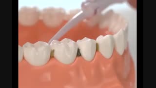 دستگاه تمیز کننده دندان پاورفلوس