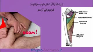 درای نیدلینگ درد کشاله ران بدنسازان توسط فیزیوتراپیست صادق زراعتکار