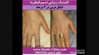 فیلم قبل وبعد از عمل جراحی های کلینیک نسیم قیطریه