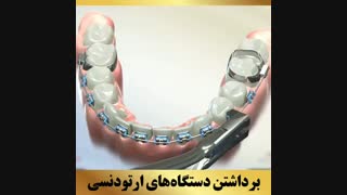 دکتر ارتودنسی | دکتر داوودیان