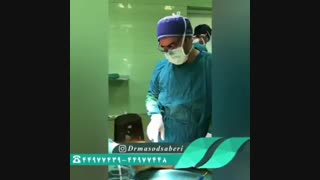 فیلم تعویض مفصل زانو در بیماری که قبلا بعلت پرانتزی بودن زانو عمل شده بود.