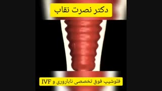 فیلم لقاح و جایگزینی جنین