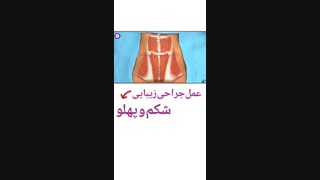 لاغری با جراحی