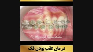 ارتودنتیست تهران | دکتر داودیان