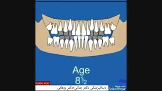 مراحل رشد و تکامل دندان انسان