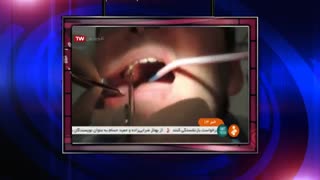 کلینیک مدرن در رسانه ملی